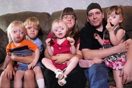 Фото - Семья с редкой генетической аномалией подверглась жестокой атаке «троллей»